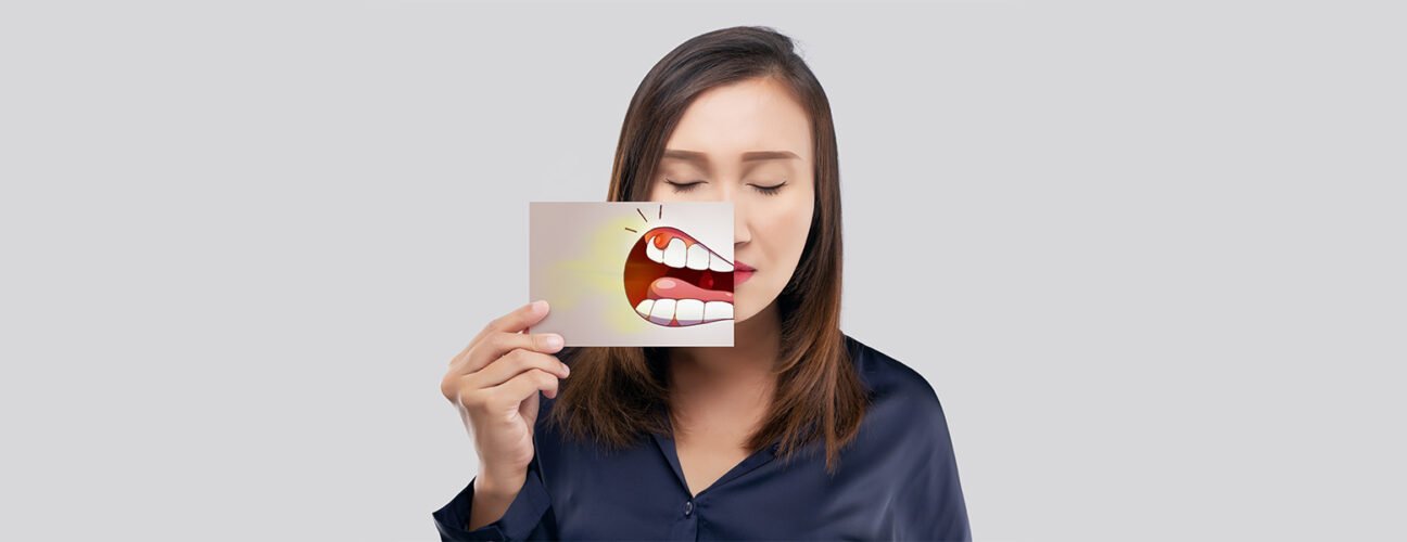 Gummy, Uneven, or Receding Gums? Explore Gum Contouring Treatment